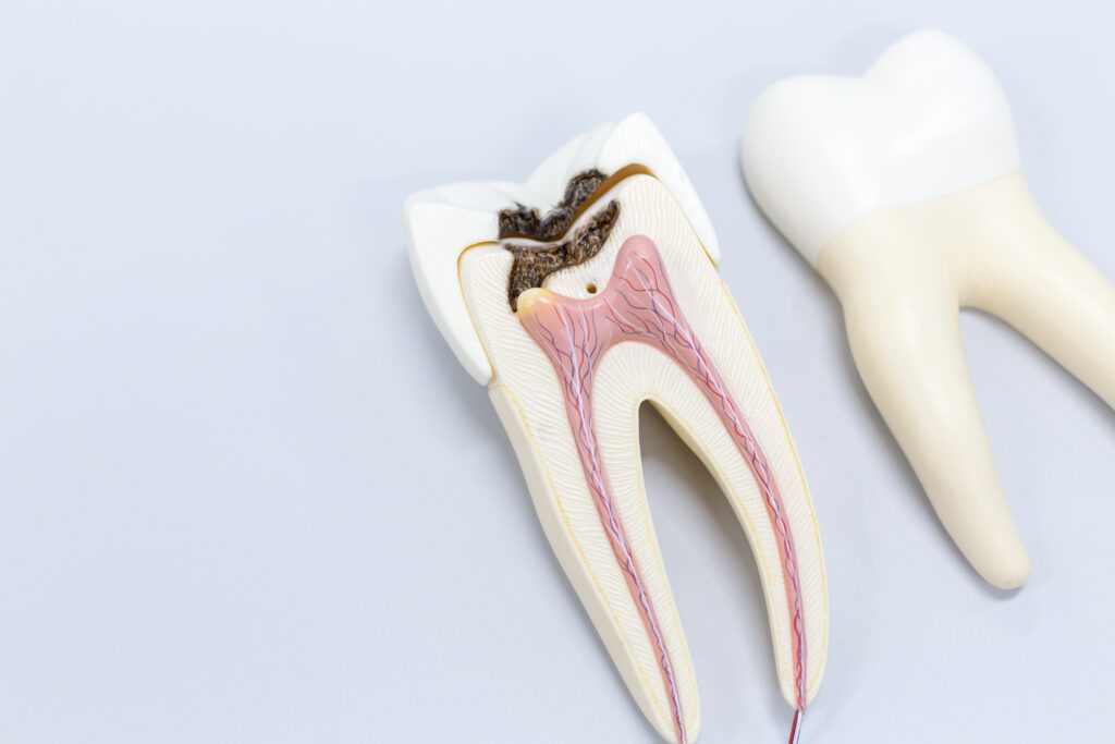 emergency endodontist in Brentwood