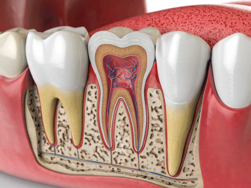 cracked tooth in Brentwood