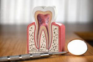root canal in Brentwood