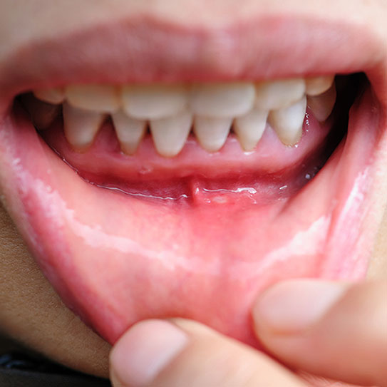 Endodontist in Brentwood
